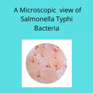 A microscopic view of Typhoid fever causing bacteria