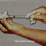 Insulin injection 3