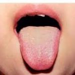 Coated tongue