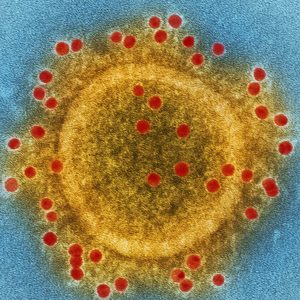 Picture of 2019 novel coronavirus under electron microscope