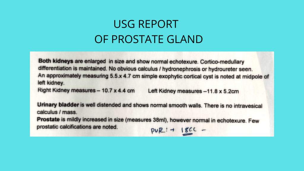 Ultrasonography scan report of enlarged prostate gland