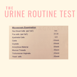 Urine routine test for Prostate disease