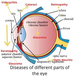 Ocular diseases of eyes including Retinopathy of Diabetes