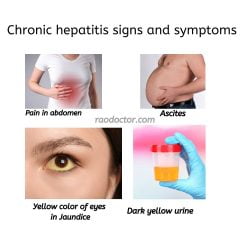 hepatitis feature image