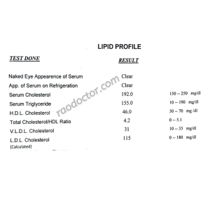 Lipid profile report showing cholesterol level