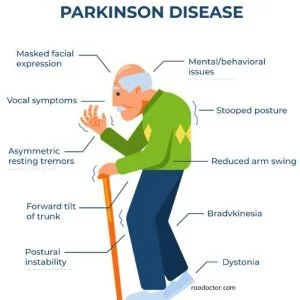 Parkinson's disease