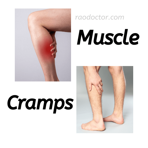 A picture showing muscle cramps