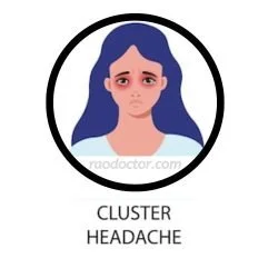 Picture depicting cluster headache
