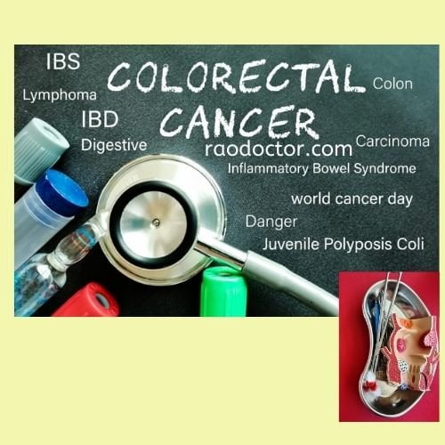 picture showing colorectal cancer