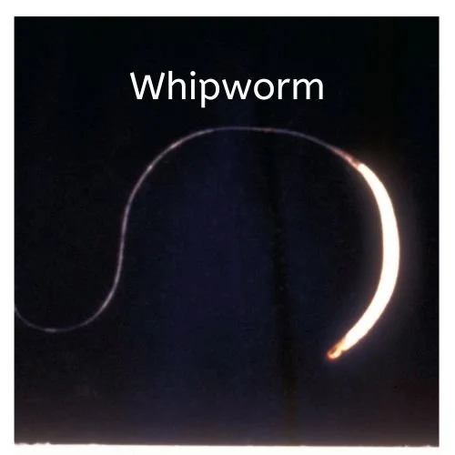 How To Know Which Type of Worms Inhabit Your Bowels- 5 Ways to Treat Them 6 Worm infestation 2
