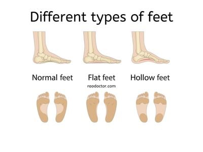 Types of feet