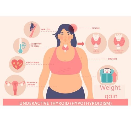 Signs/symptoms of Hypothyroidism