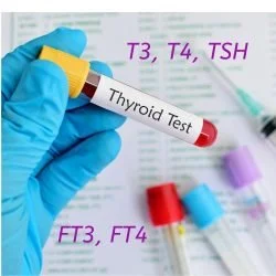 Thyroid tests