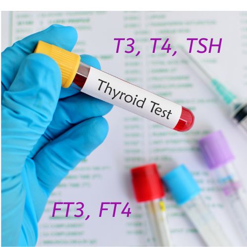 THYROID TESTS