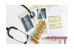 Featured Image for Osteoporosis