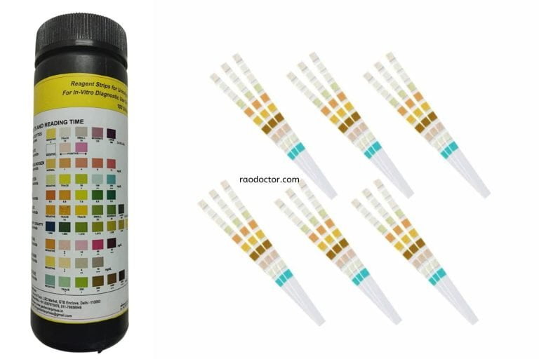 What Your Urine Microscopy And Dipstick Results Mean