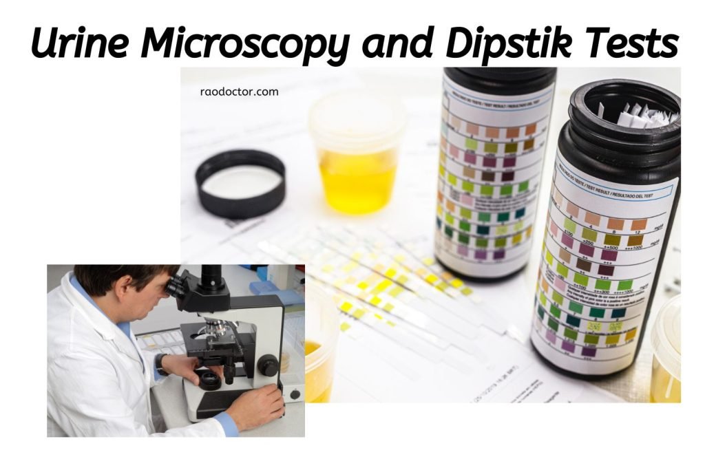 Featured image for urine microscopy and dipstick test