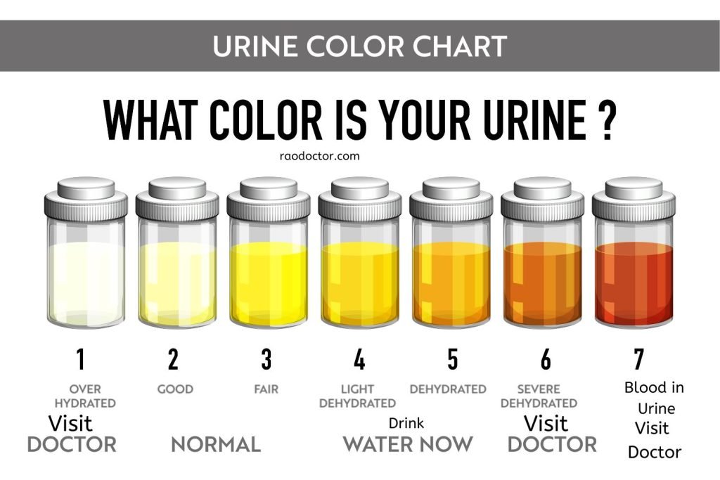 Urine color chart in Urine Microscopy