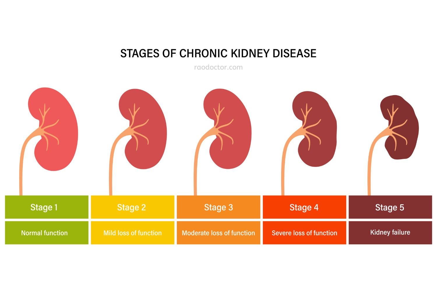 What You Need To Know About Chronic Kidney Disease