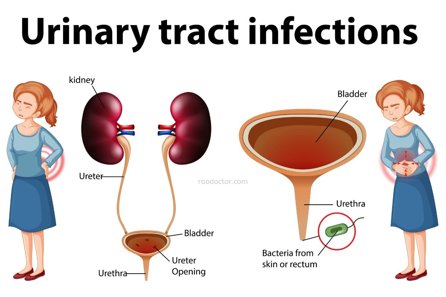 Urinary Tract Infections How To Diagnose And Treat Them 4147