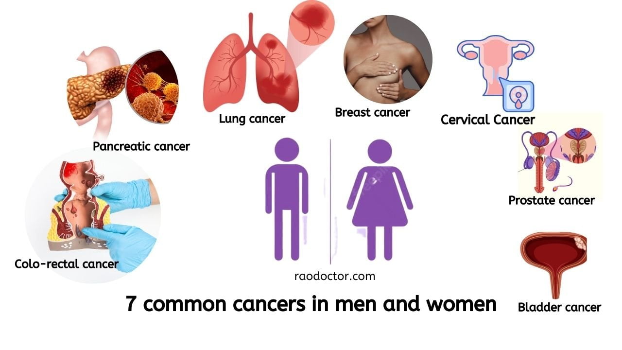 7 Common Cancers In Men And Women
