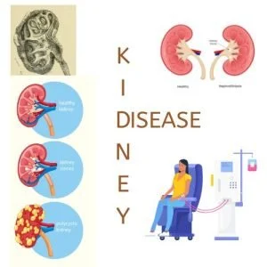 Image showing various kidney disease