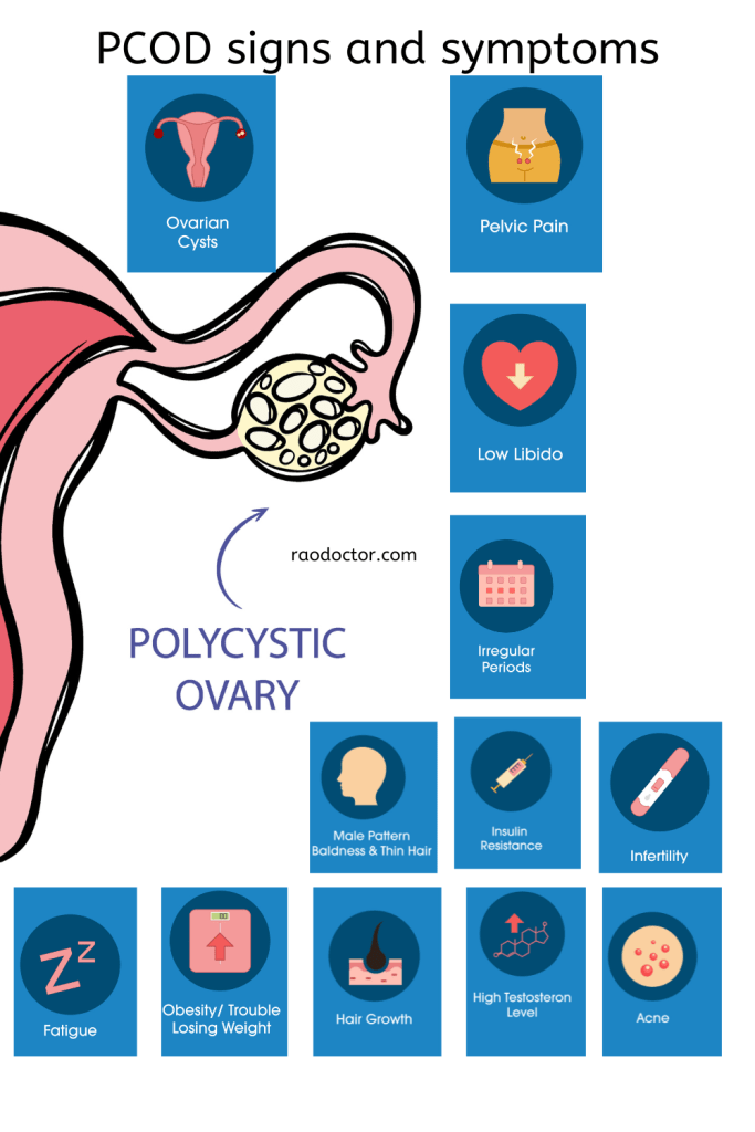 Polycystic Ovarian Disease signs and symptoms