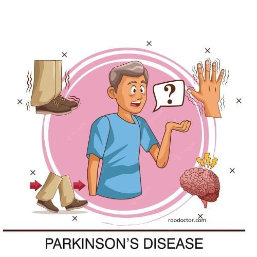Image showing signs and symptoms of Parkinson's disease