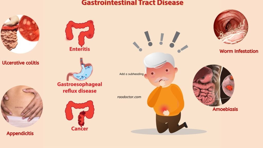 Picture showing various Gastro-intestinal diseases