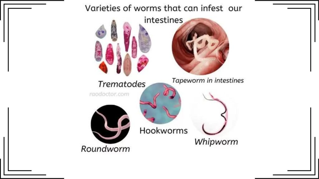 Picture showing various worm infestation in Gastro-intestinal [GI] diseases