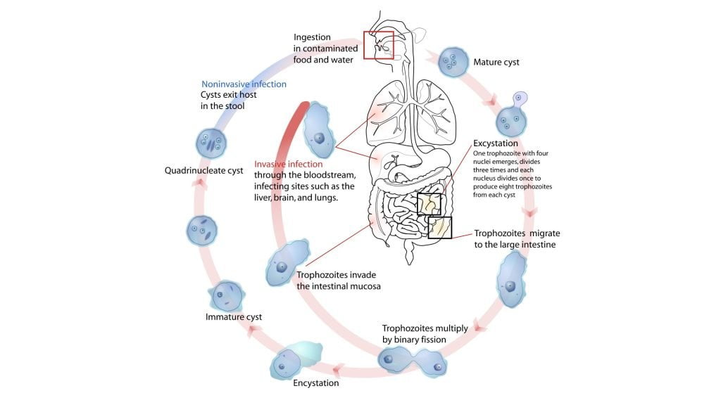 Amoebiasis in gi diseases