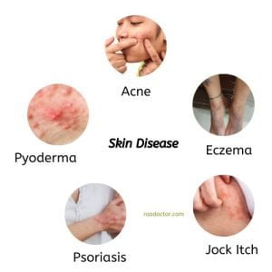 5 skin diseases