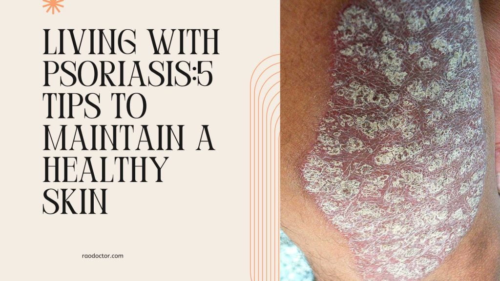 Living with Psoriasis5 Tips to maintain a healthy skin