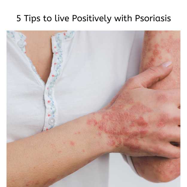 Image showing Psoriasis