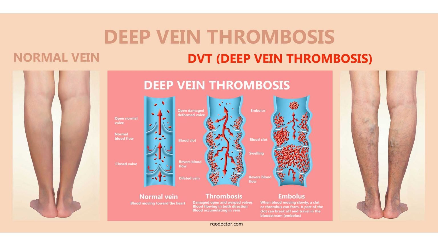 Dr. K. P. V. Rao's Health Blogs