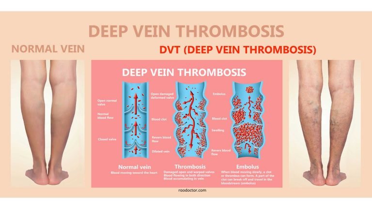 Dr. K. P. V. Rao's Health Blogs