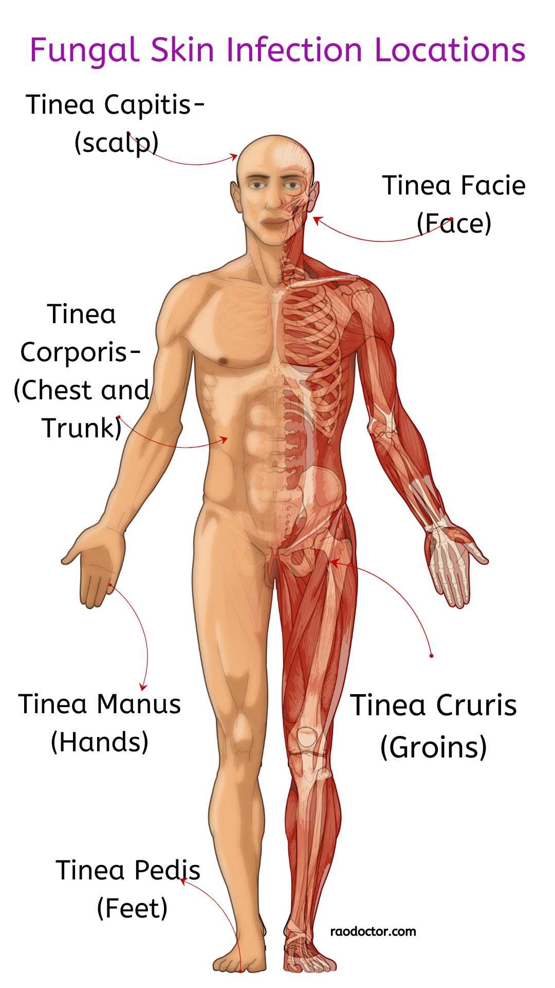 Skin Funicle Ultimate Guide To Fungal Skin Infections-How To Tackle Them
