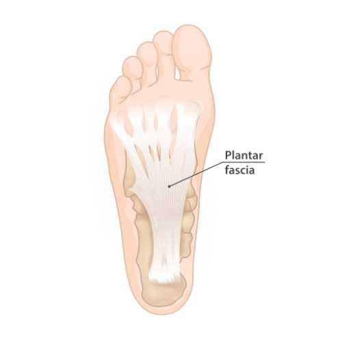 Plantar Fascia that gets inflamed in plantar fasciitis