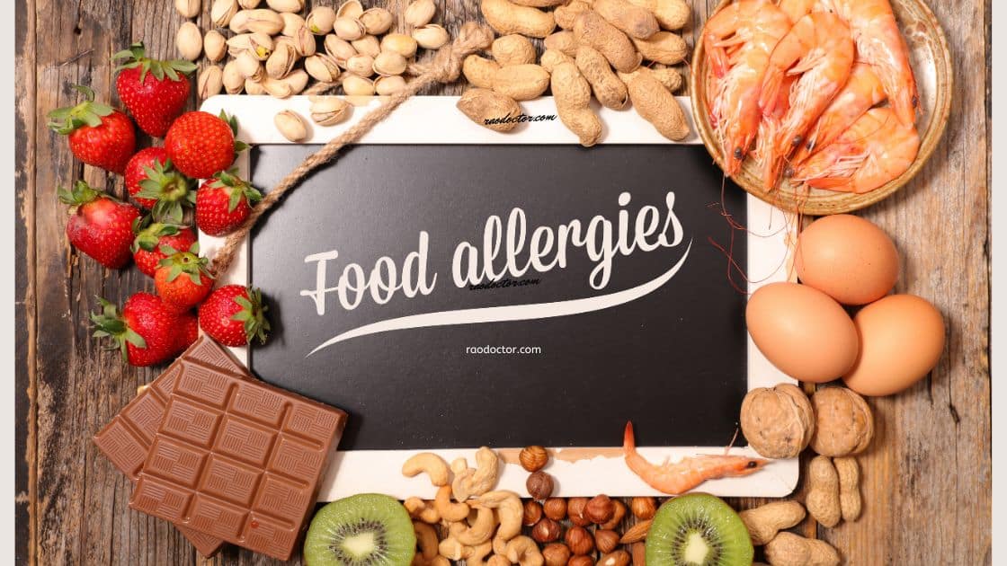 Blog banner showing food allergies