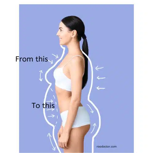 Reverse obesity by weight loss