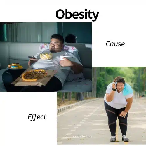 Obesity cause and effect