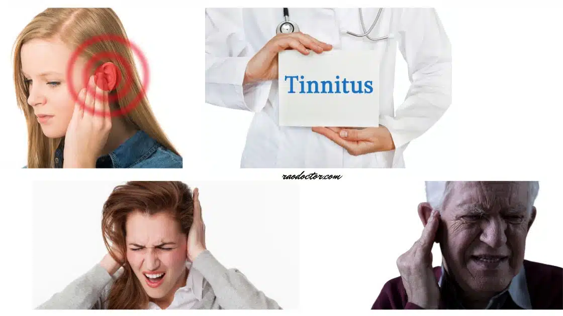 Internal ear disorder- tinnitus