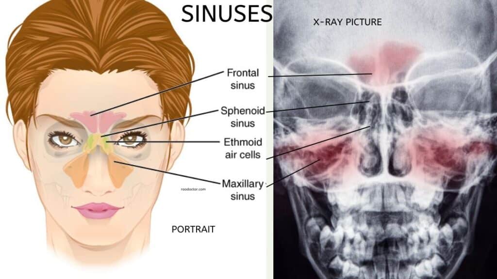 Featured image for common diseases of ear, nose and throat