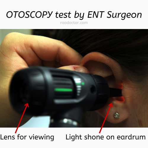 Doctor doing an otoscopy in a patient