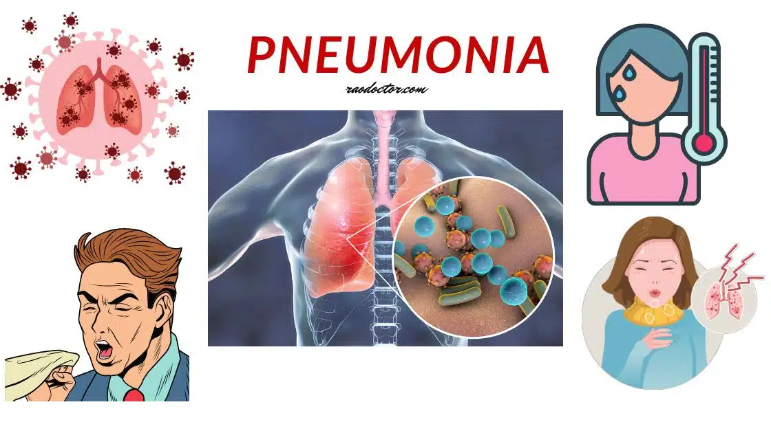 Pneumonia article featured image