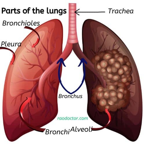 Parts of lungs in study of pneumonia
