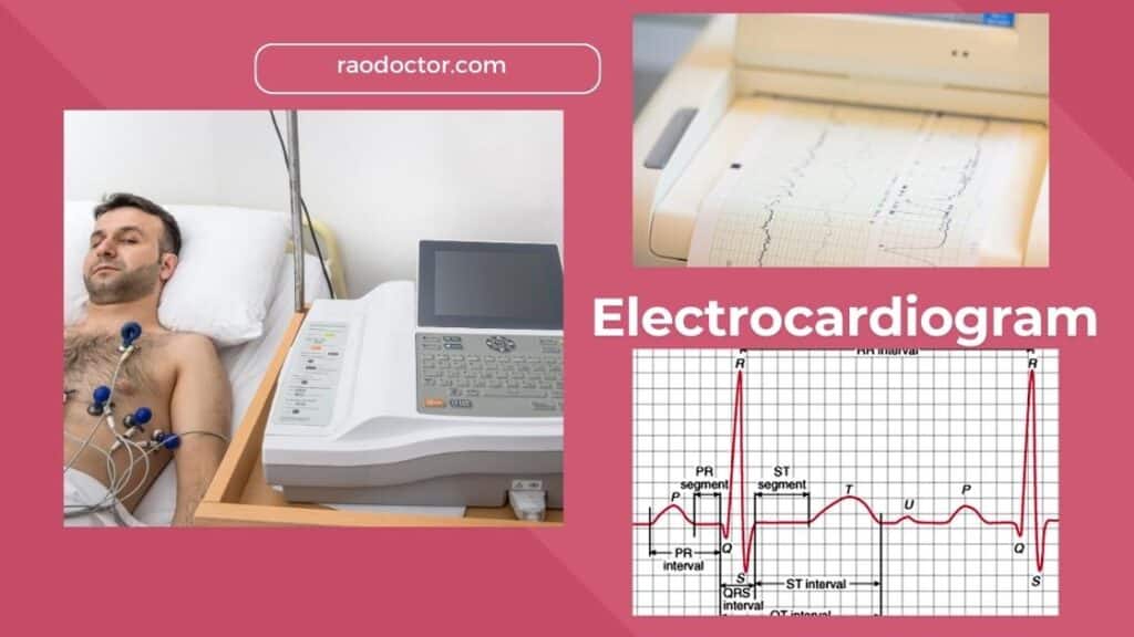 Featured image for article on Electrocardiogram