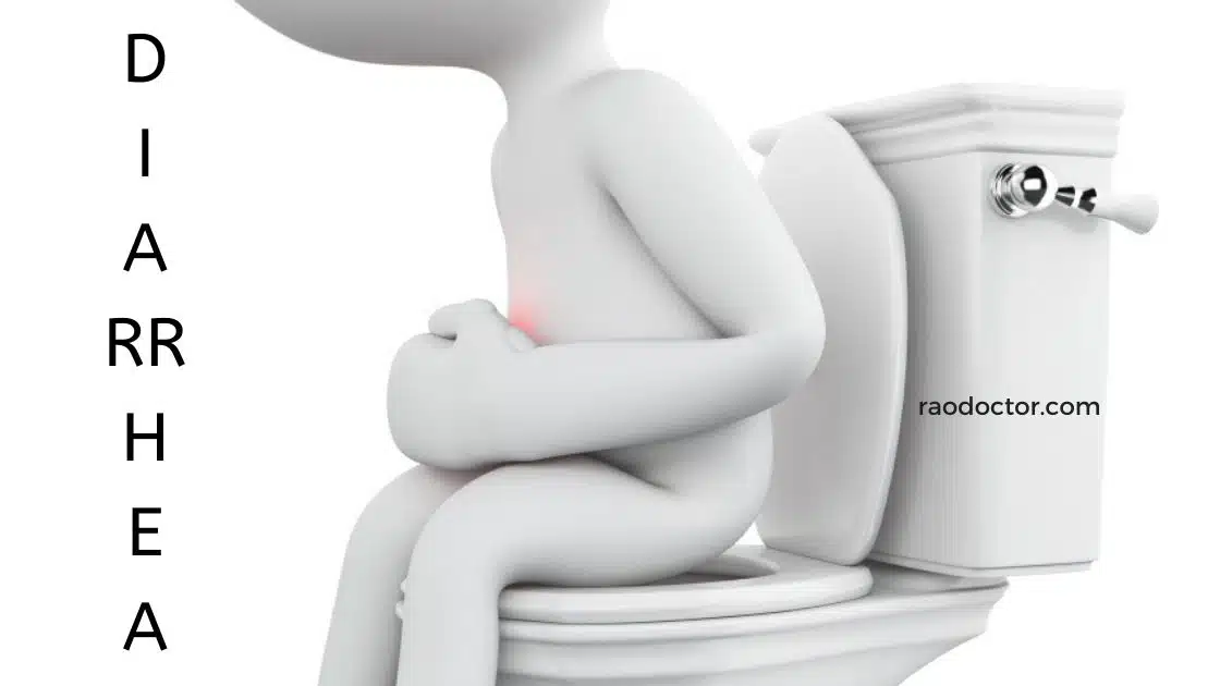 Faetured image for the topic on diarrhea and dysentery