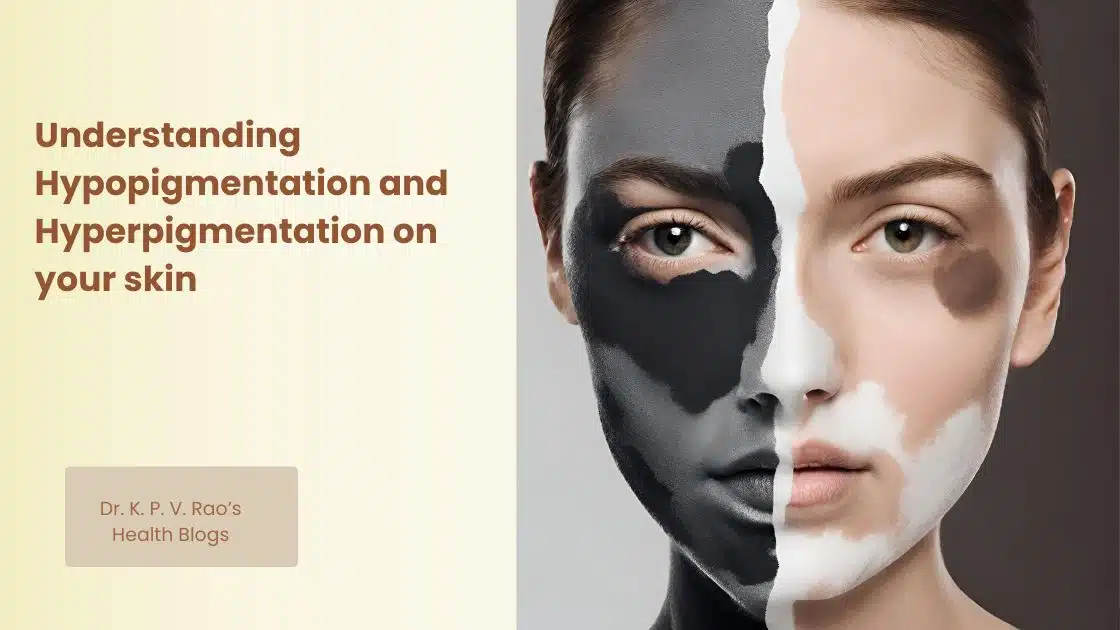 Image showing the contrast between hypopigmentation and hyperpigmentation