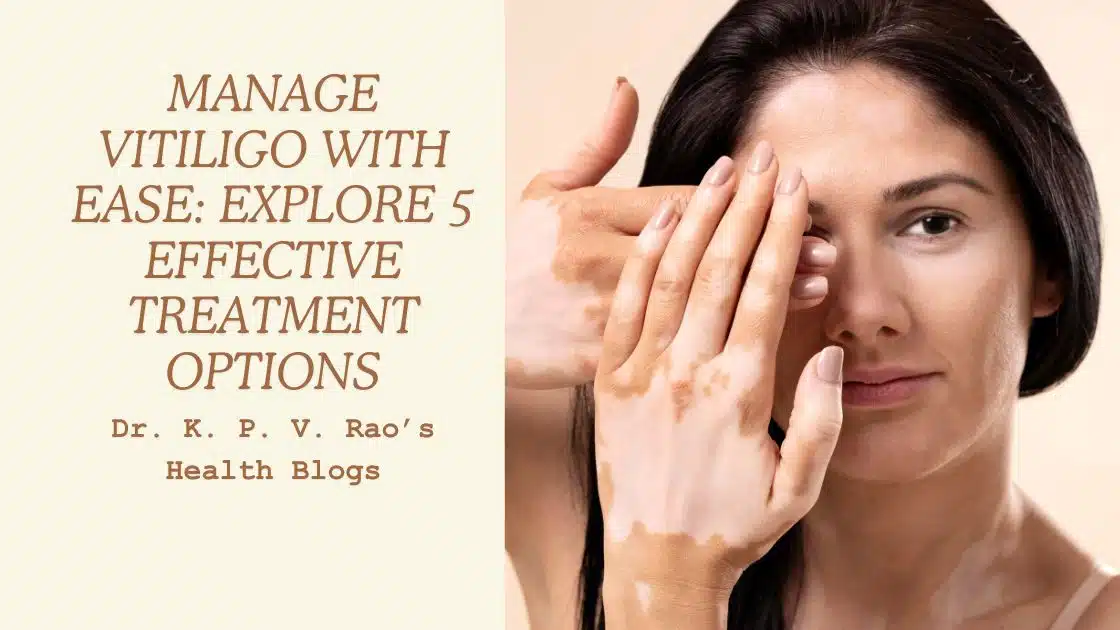 Featured image for article on vitiligo treatment